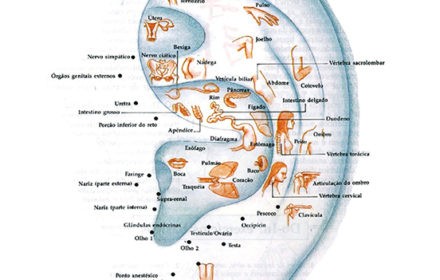 AURICULOTERAPIA